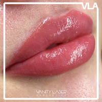 Lip Blush Tattoo - Vanitylaser