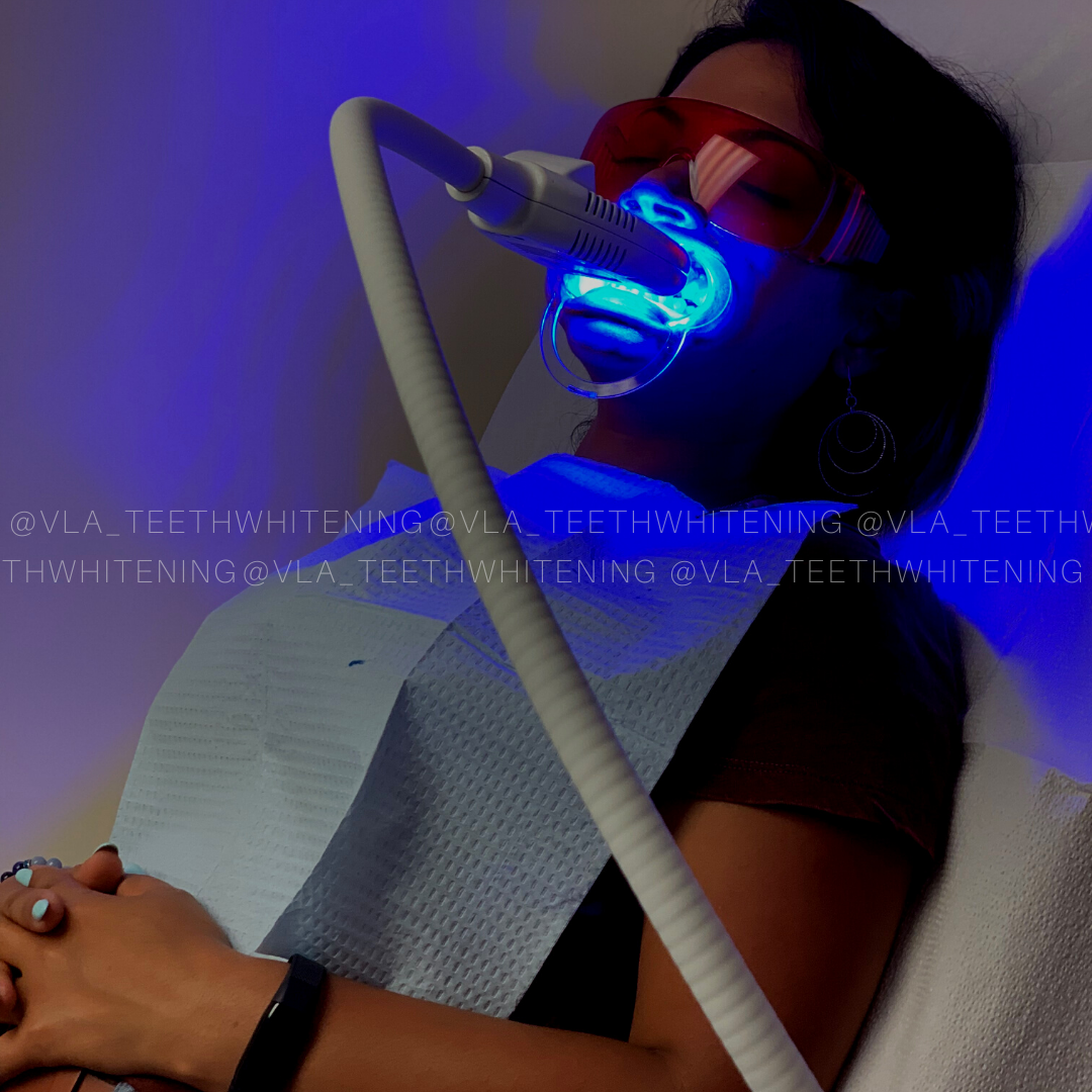 Cosmetic Teeth Whitening