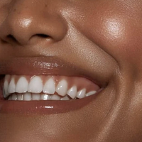 Cosmetic Teeth Whitening